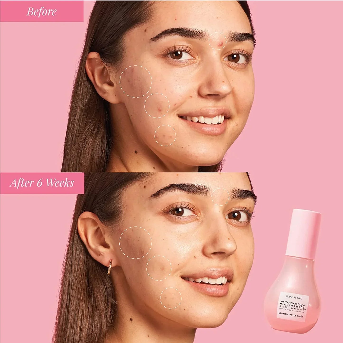 Watermelon Mini Niacinamide Dew Drops Serum